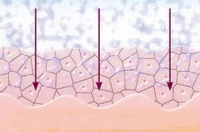 Mikrodermabrasion Wirkung